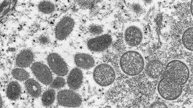Image of monkeypox virus under an electron microscope.