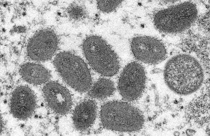 Image of monkeypox virus under an electron microscope.