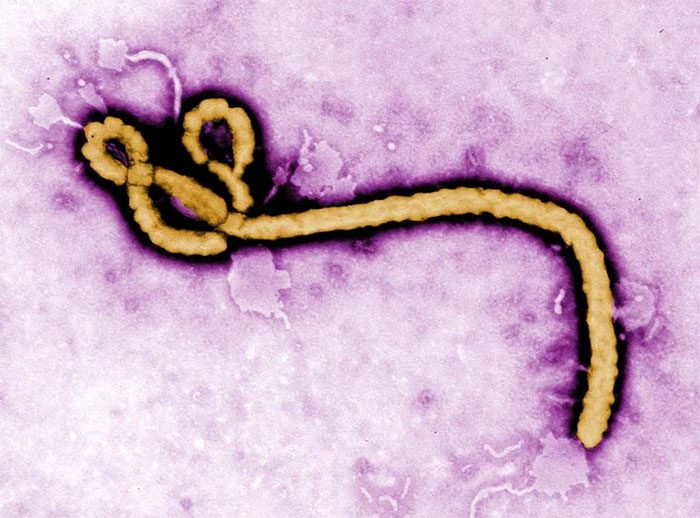 Ebola found hiding in the brain, semen, and lens of treated patients