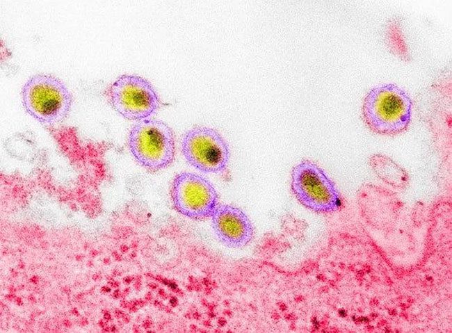 HIV-1 was identified nearly 40 years ago.