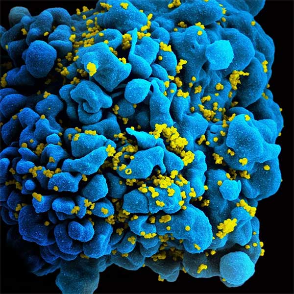 HIV Virus