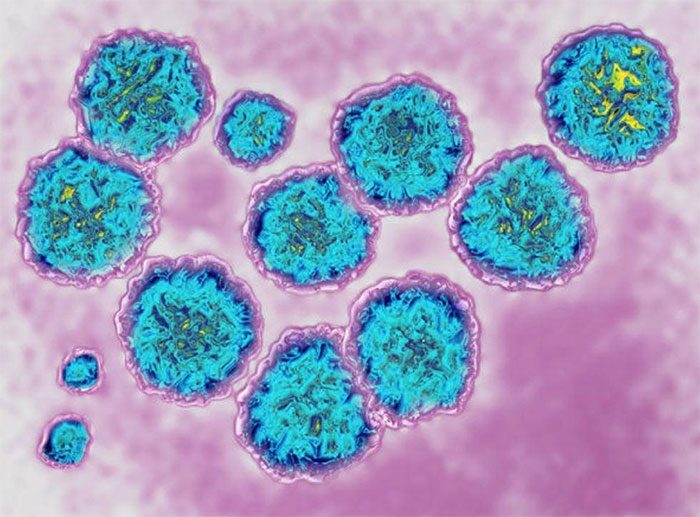 The Hepatitis C virus changes shape, posing challenges for experts