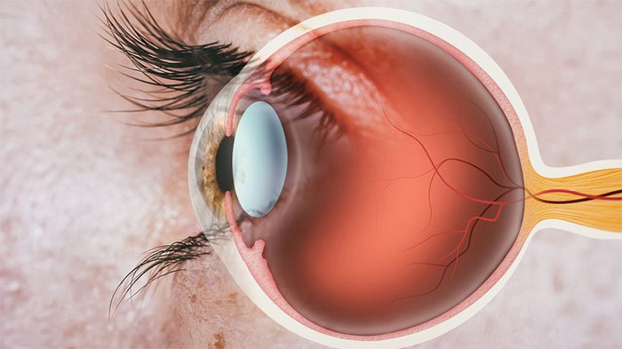 Retina