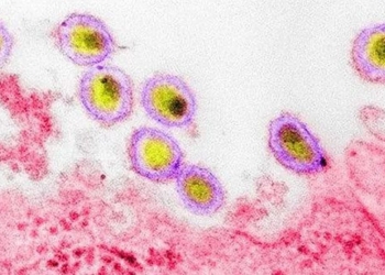 warning message for the covid 19 pandemic from the new hiv 119285