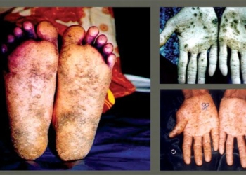 we can live together with toxic substances 68 times more than arsenic in the kitchen and not even know 103941