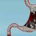 what happens to the body if you swallow galley 122598