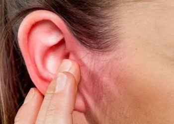what is outer ear inflammation 121769