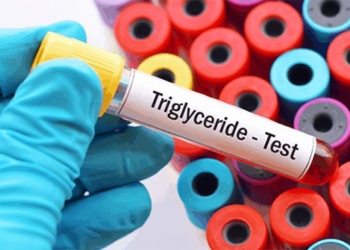 what is triglyceride level 121000