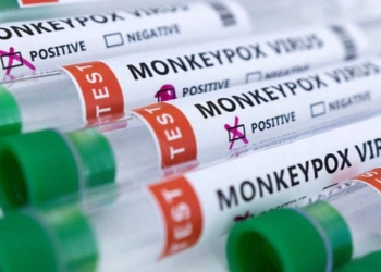 who discovers virus causing seasonal flu during patient 121160 epidemic