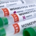 who discovers virus causing seasonal flu during patient 121160 epidemic