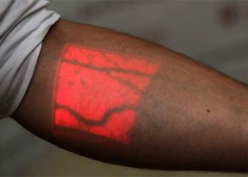 why red arteries have blue blood 122267