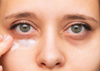 why sleeping dreaming but still have dark circles 123577