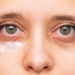 why sleeping dreaming but still have dark circles 123577