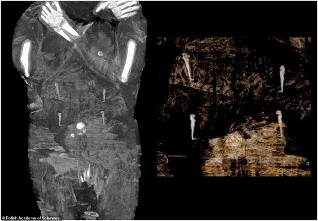 The abdomen of the mummy has amulet plates.