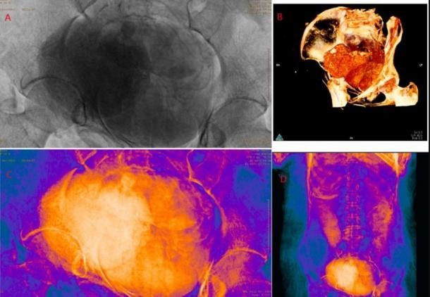 The abdomen of the mummy in a series of scans by scientists.