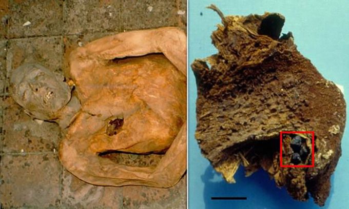 The mummy of an Italian nobleman (left), liver and gallbladder of Giovani d'Avalos (right).