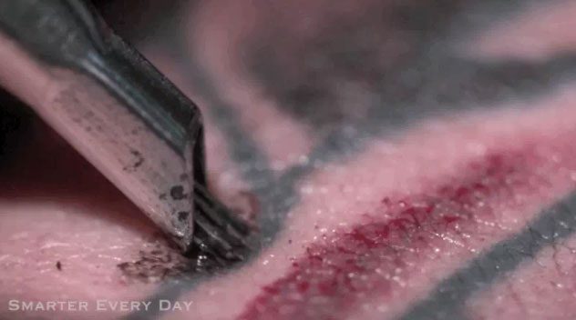 Directly delivered by tattoo needles into the dermis, the drug was absorbed more effectively than topical application