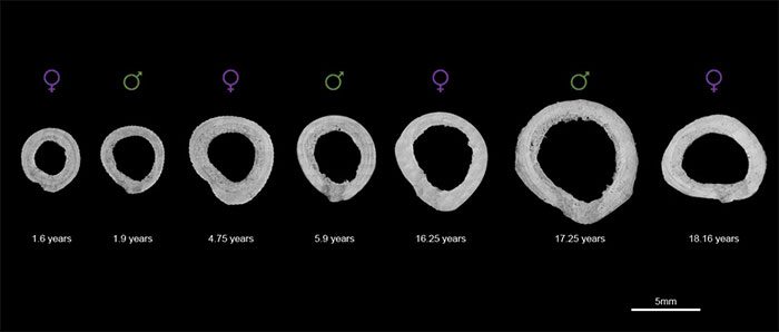 Microscopic cross-section images of 7 femurs identified by age and gender