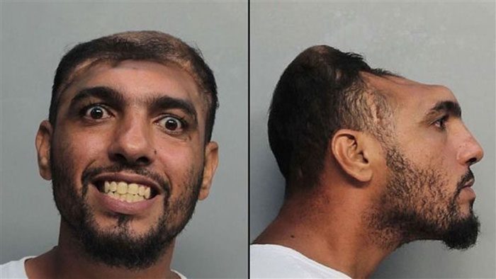 Despite losing part of his brain, he retains all his memories and mental abilities.