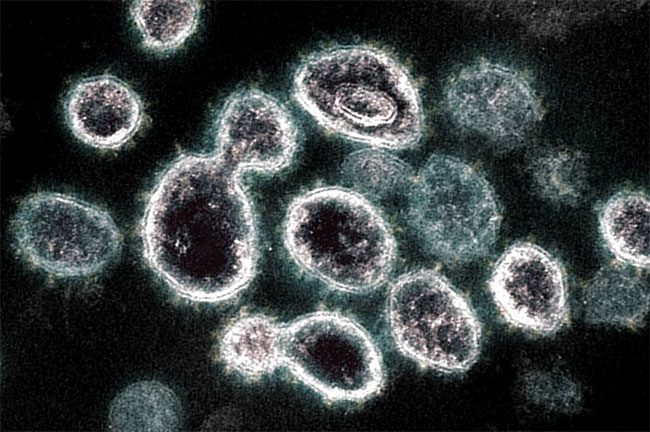SARS-CoV-2 Virus.
