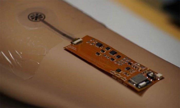 The bandage is being tested on patients with venous ulcers or leg ulcers