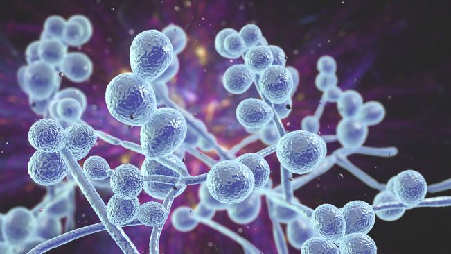 The world has witnessed the emergence of many independent cases of Candida auris infection.