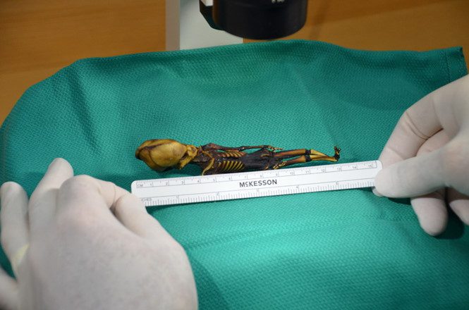 The skeleton found in a desert in Chile.