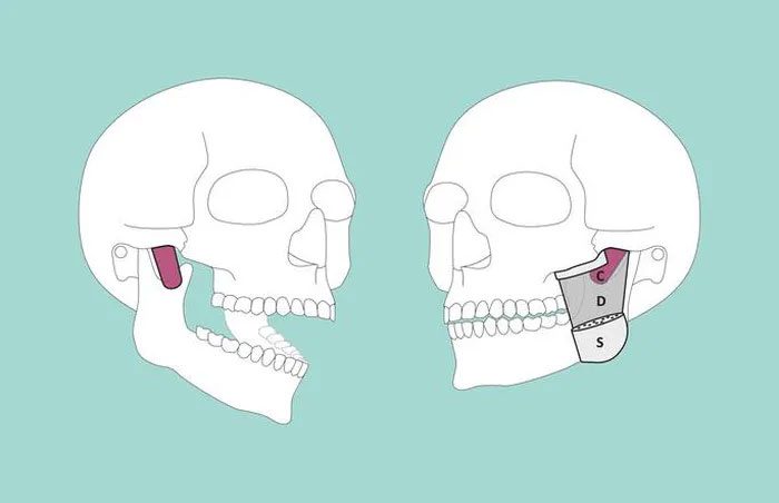 Graphic depicting the structure discovered in the human body, specifically in the jaw area.