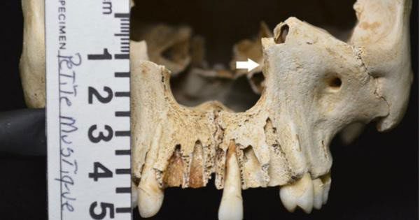 Deformed skull discovered on this uninhabited island