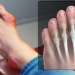 difference between gout and rheumatoid arthritis 117396
