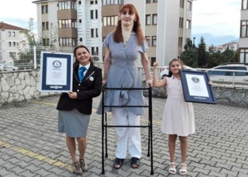 disease that causes spanish girl to be over 2m tall 116524