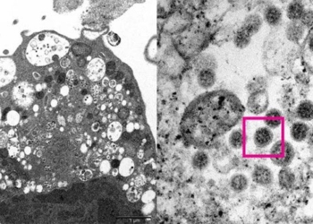 first image release of omicron variant under electronic microscope 117611