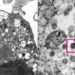 first image release of omicron variant under electronic microscope 117611