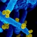 how the variant vaccine mu evolves dramatically 116389