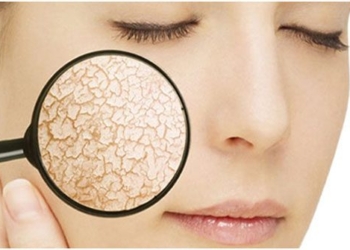 how to treat dry skin and cracked lips in winter 117477