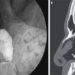 many years later man goes to examine strange object growing in nose 117537