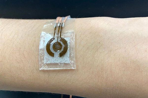 Non-invasive blood glucose monitoring device