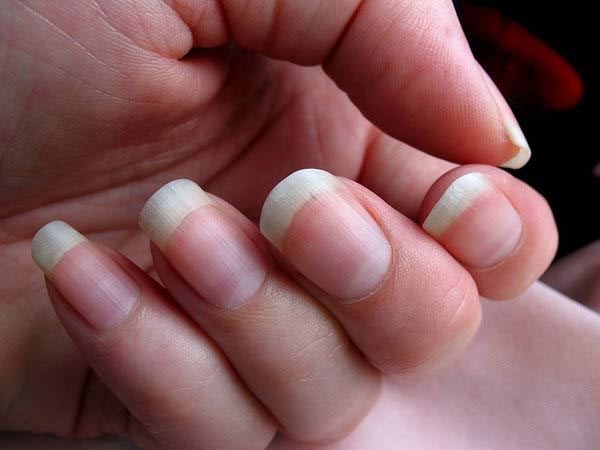 Reasons why fingernails grow faster than toenails