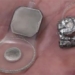new biotechnology can restore vision for the blind 117825