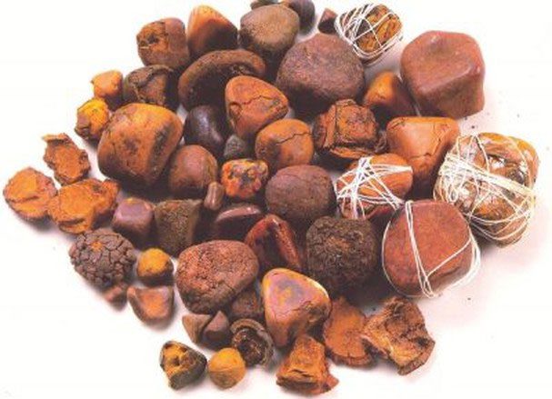 Bovine Gallstone