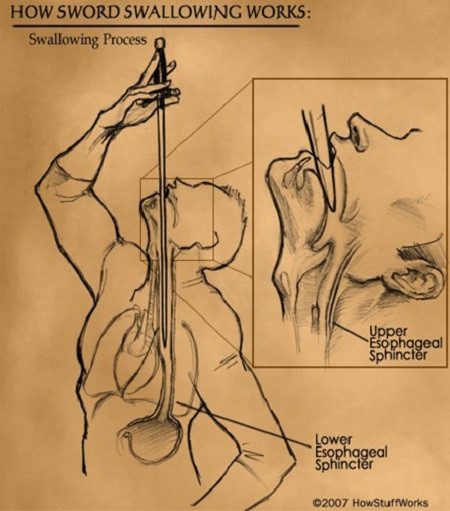 Image depicting the sword passing through two sphincters and straightening the upper GI tract
