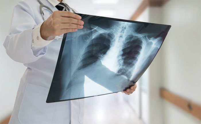 SnS nano sheets allow for efficient X-ray absorption