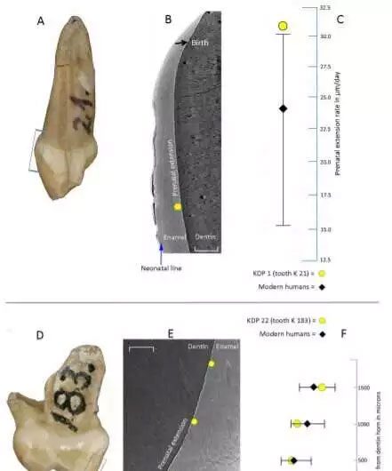 Neanderthal child's incisors