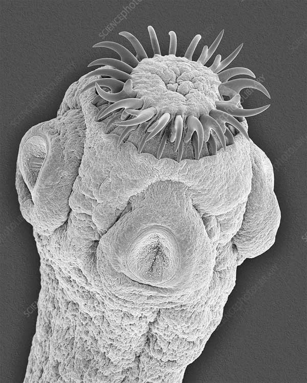 Tapeworm living in the intestines of mammals.