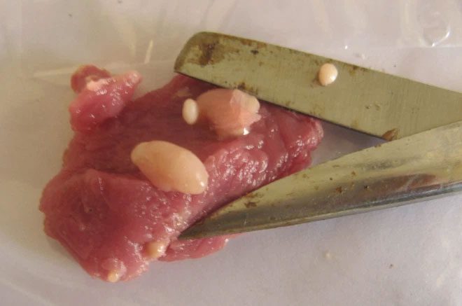Cyst of a tapeworm in pork.