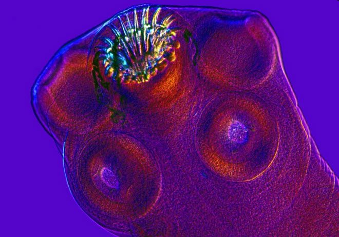 Head of a pork tapeworm.