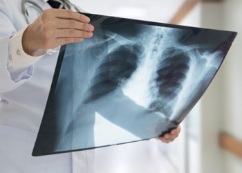successful creation of the worlds thinnest x ray device 117050