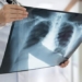 successful creation of the worlds thinnest x ray device 117050