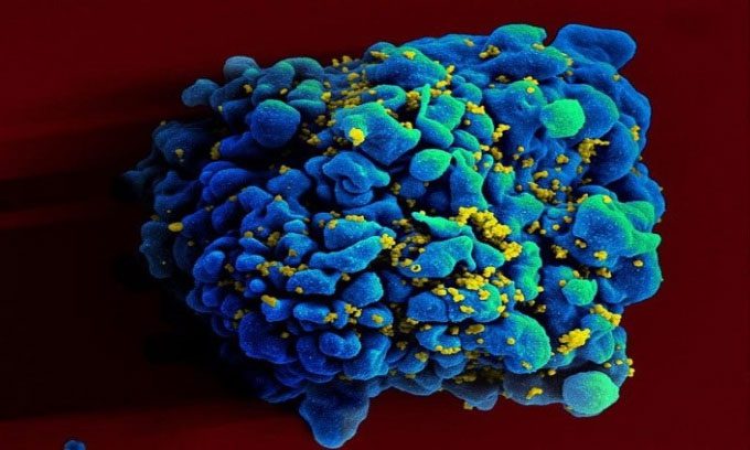 Electron microscope image of T cells H9 infected with HIV.