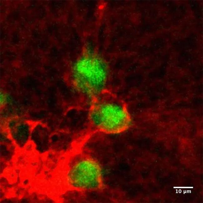 Cancer Cells